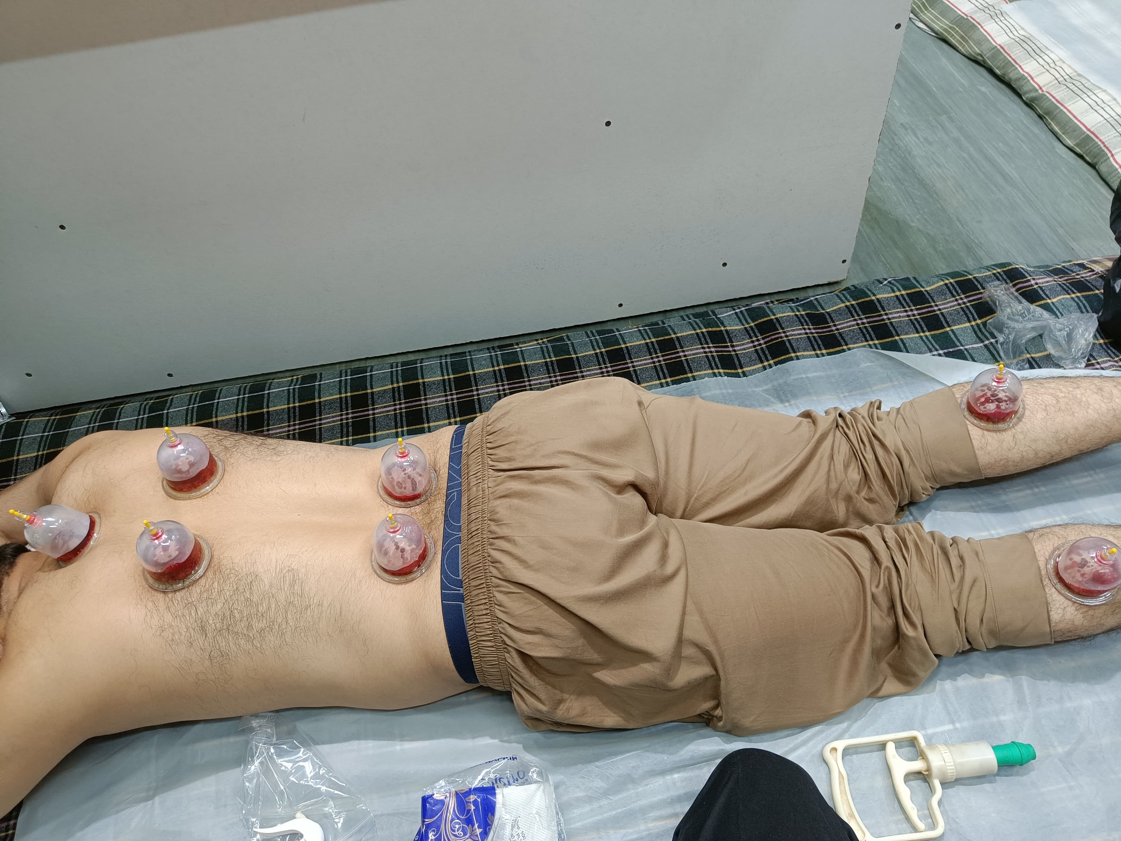 Hijama camp 3
